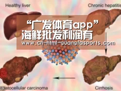 “广发体育app”海鲜批发利润有多大(图1) 广发体育